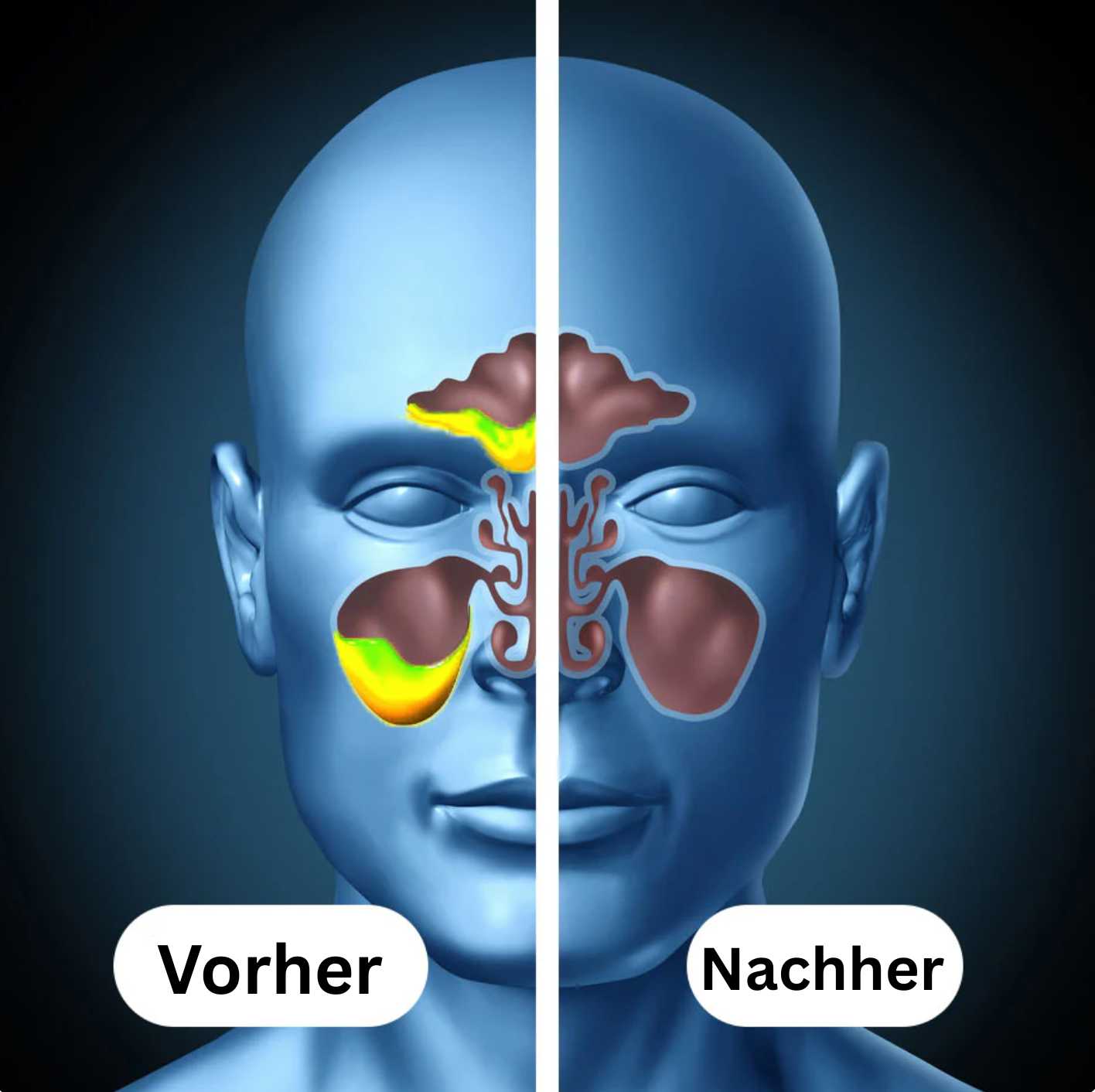 NasalFrei – Natürlich frei durchatmen
